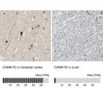 Atlas Antibodies Anti-CAMK1D Antibody