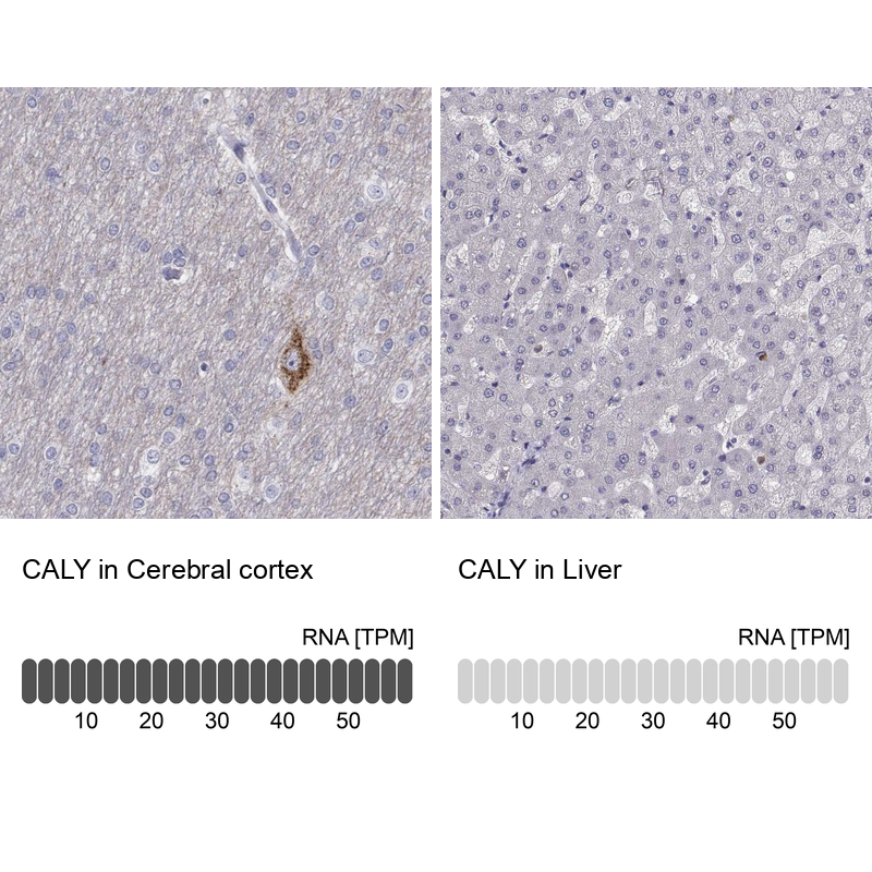 Atlas Antibodies Anti-CALY Antibody