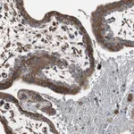 Atlas Antibodies Anti-CALU Antibody