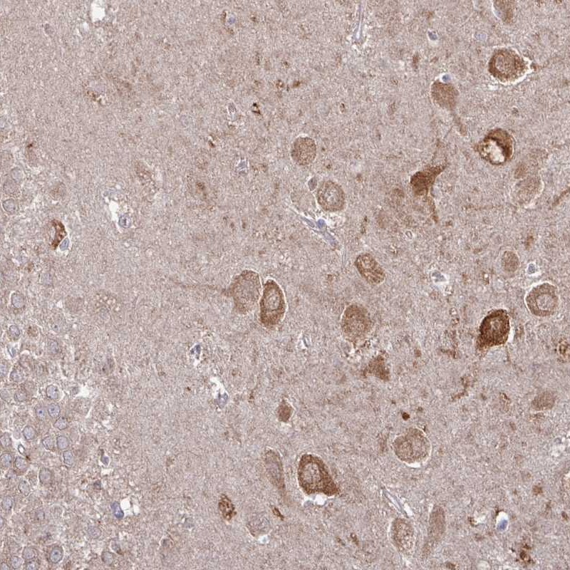 Atlas Antibodies Anti-CAMK2A Antibody