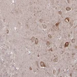 Atlas Antibodies Anti-CAMK2A Antibody