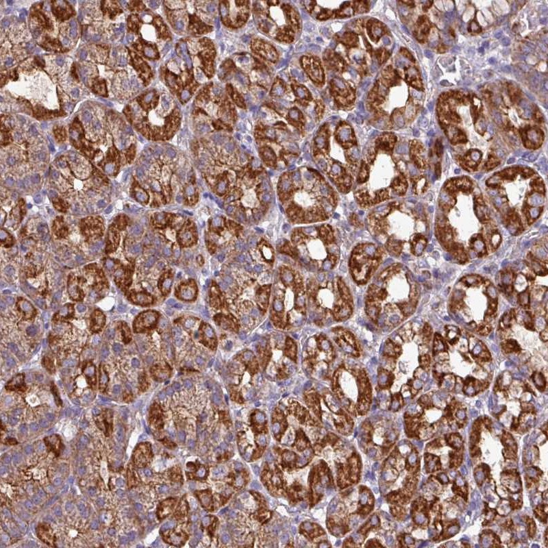 Atlas Antibodies Anti-CAMK1 Antibody