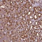 Atlas Antibodies Anti-CAMK1 Antibody