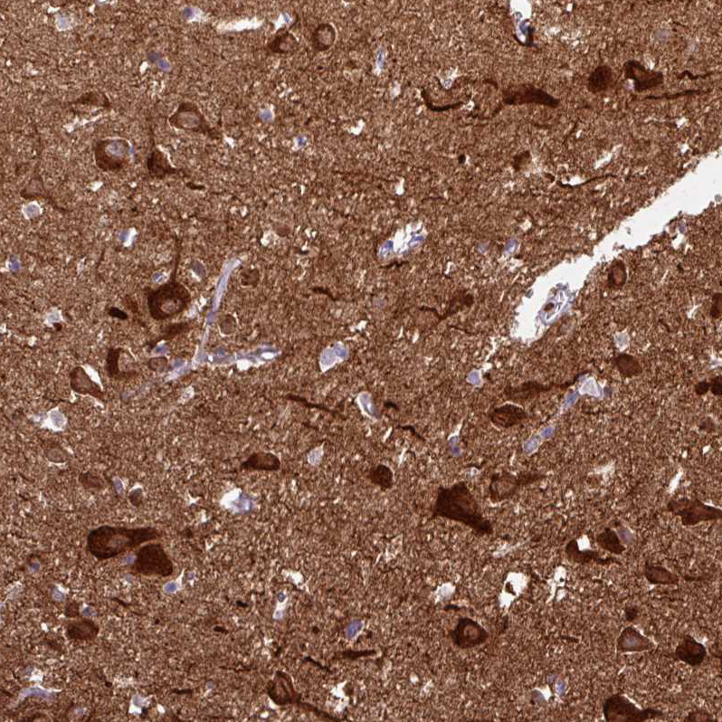 Atlas Antibodies Anti-CAMK2A Antibody