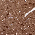 Atlas Antibodies Anti-CAMK2A Antibody