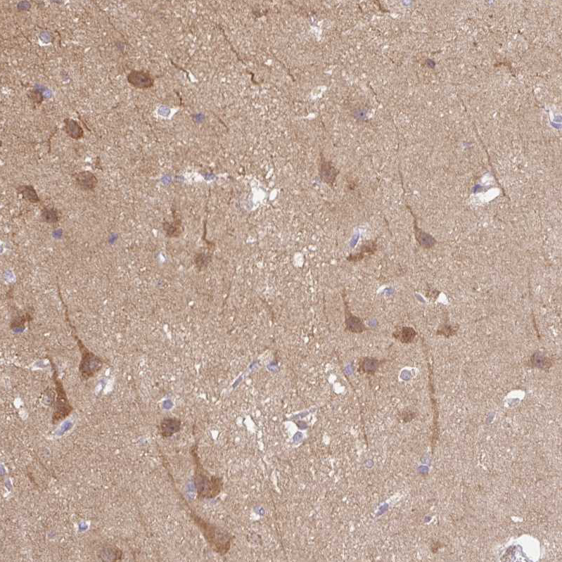 Atlas Antibodies Anti-CAMK2A Antibody