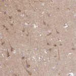 Atlas Antibodies Anti-CAMK2A Antibody