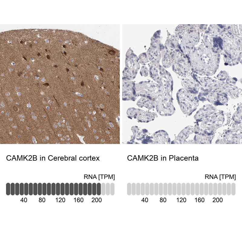 Atlas Antibodies Anti-CAMK2B Antibody