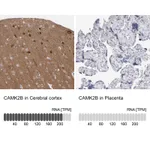 Atlas Antibodies Anti-CAMK2B Antibody