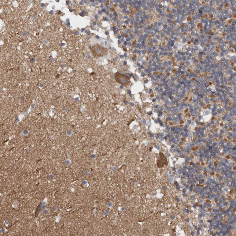 Atlas Antibodies Anti-CAMK2D Antibody
