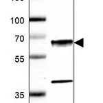Atlas Antibodies Anti-CAMK2G Antibody