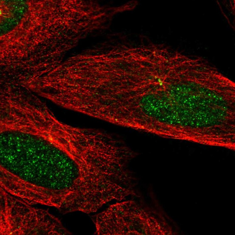 Atlas Antibodies Anti-CAMK2N2 Antibody
