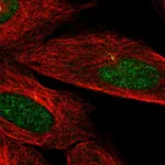 Atlas Antibodies Anti-CAMK2N2 Antibody