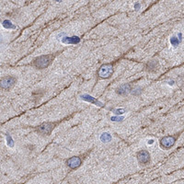 Atlas Antibodies Anti-CAMK2N2 Antibody