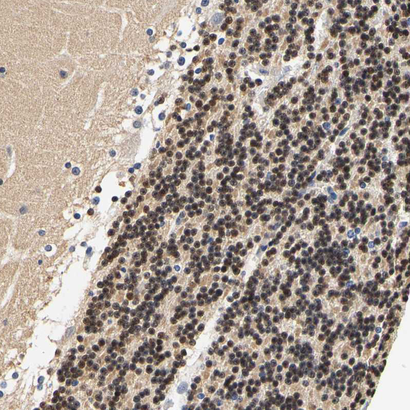 Atlas Antibodies Anti-CAMK4 Antibody
