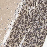 Atlas Antibodies Anti-CAMK4 Antibody