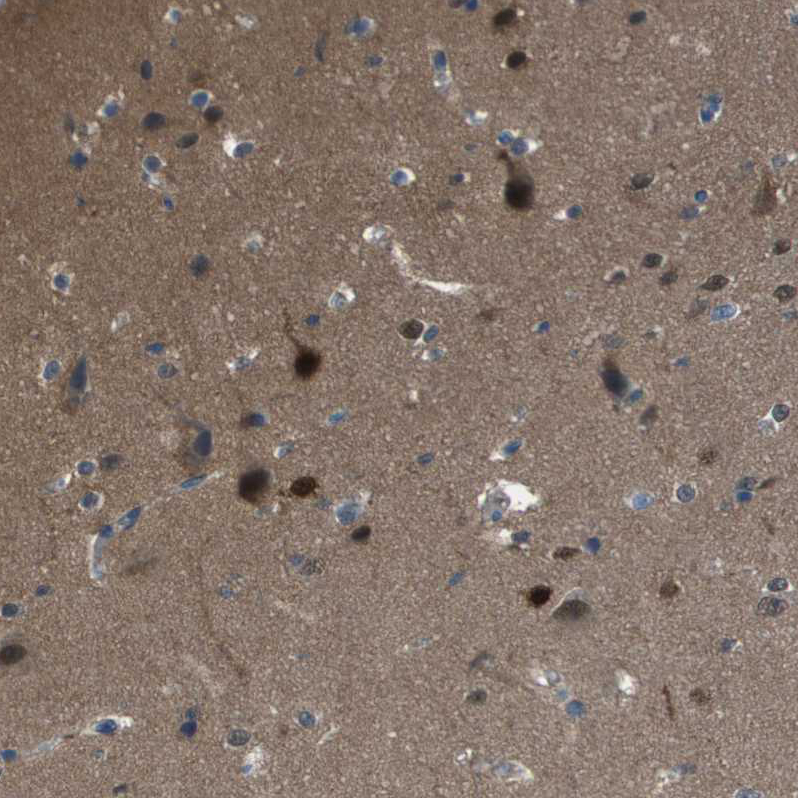 Atlas Antibodies Anti-CAMK4 Antibody