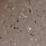 Atlas Antibodies Anti-CAMK4 Antibody