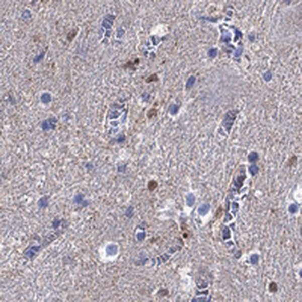 Atlas Antibodies Anti-CAMKK2 Antibody