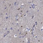 Atlas Antibodies Anti-CAMKK2 Antibody