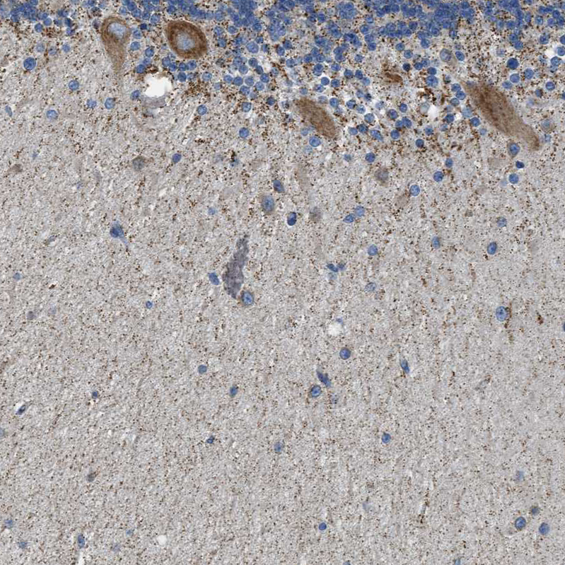 Atlas Antibodies Anti-CAMKK2 Antibody