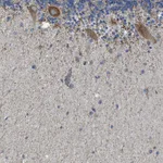 Atlas Antibodies Anti-CAMKK2 Antibody