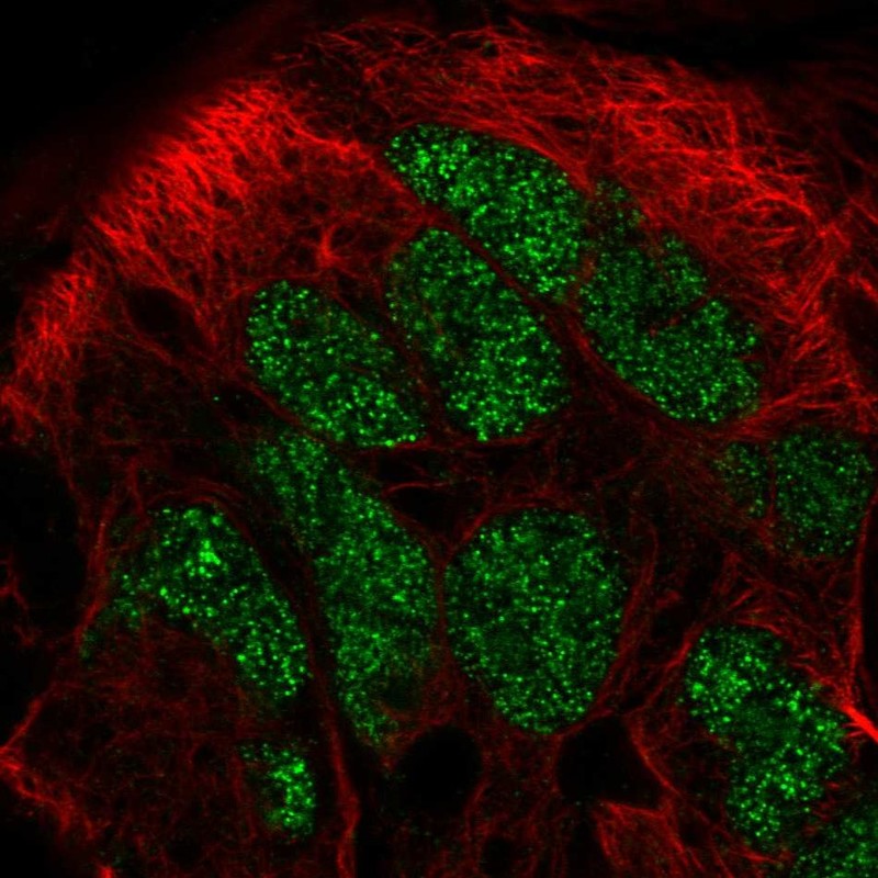 Atlas Antibodies Anti-CAMKMT Antibody