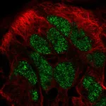 Atlas Antibodies Anti-CAMKMT Antibody