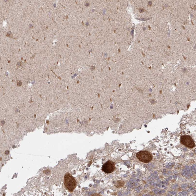Atlas Antibodies Anti-CAMLG Antibody