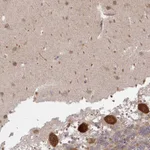 Atlas Antibodies Anti-CAMLG Antibody