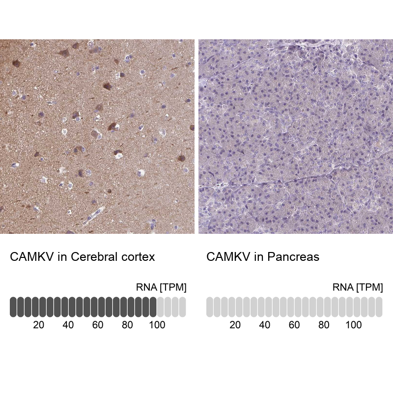 Atlas Antibodies Anti-CAMKV Antibody