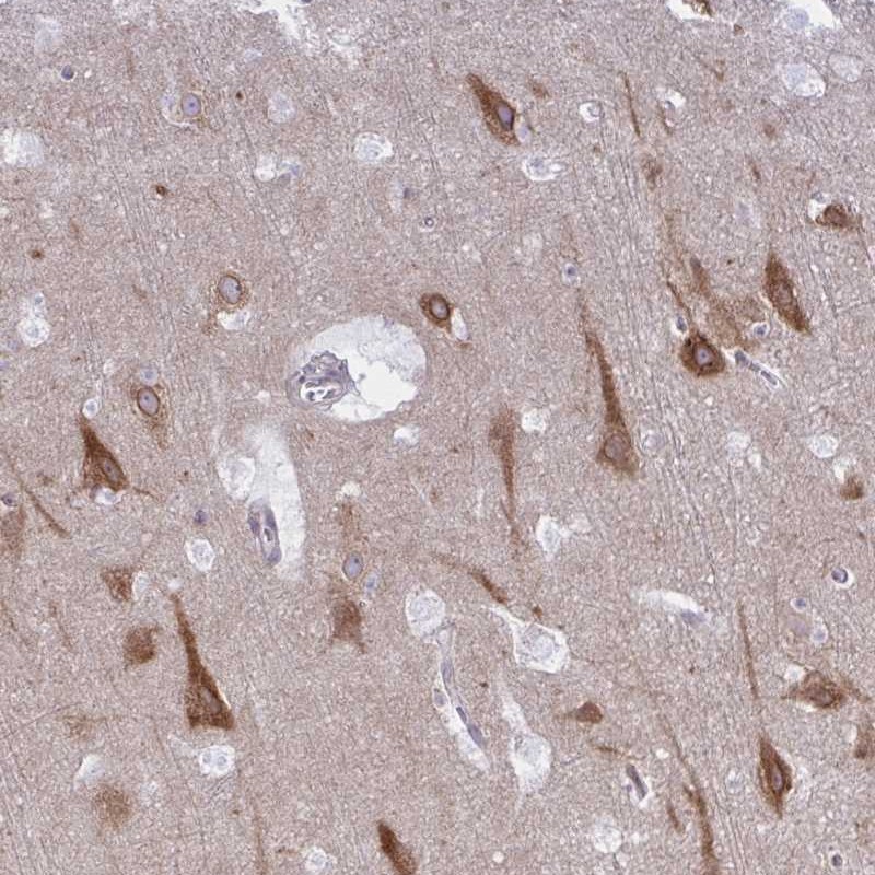 Atlas Antibodies Anti-CAMLG Antibody