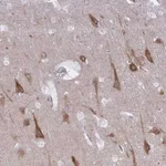 Atlas Antibodies Anti-CAMLG Antibody