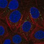 Merck Anti-DSCAM antibody produced in rabbit