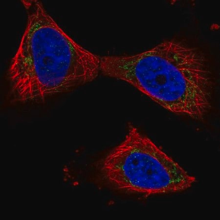 Merck Anti-PPP3CB antibody produced in rabbit