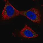 Merck Anti-PPP3CB antibody produced in rabbit