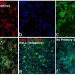 Thermo Fisher Scientific Goat anti-Mouse IgG2a Cross-Adsorbed Secondary Antibody, Alexa Fluor 546