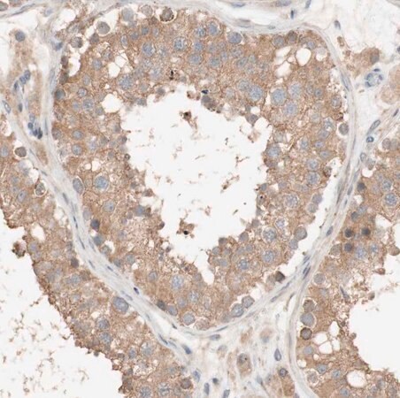 Merck Anti-DEUP1 antibody produced in rabbit
