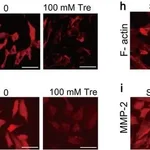 Thermo Fisher Scientific Donkey anti-Mouse IgG (H+L) Highly Cross-Adsorbed Secondary Antibody, Alexa Fluor 555