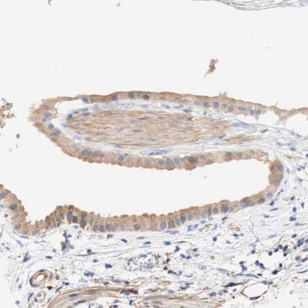 Merck Anti-EIF2AK4 antibody produced in rabbit