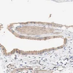 Merck Anti-EIF2AK4 antibody produced in rabbit