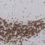 Merck Anti-PHF2 antibody produced in rabbit