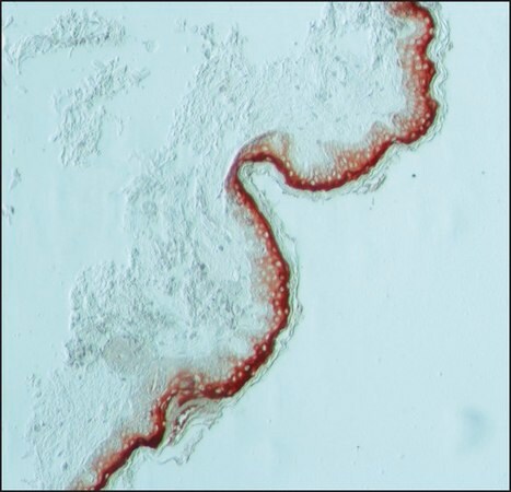 Merck Anti-Involucrin antibody, Mouse monoclonal
