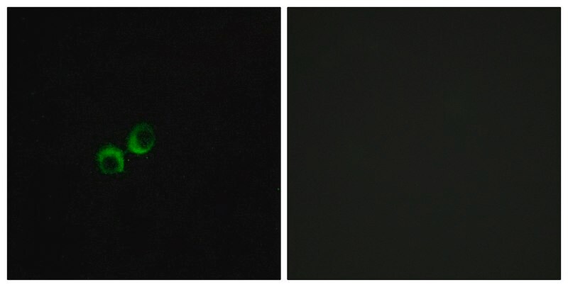 Merck Anti-TAS1R3 antibody produced in rabbit