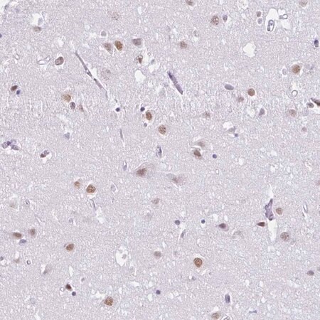 Merck Anti-DCAF17 antibody produced in rabbit