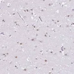 Merck Anti-DCAF17 antibody produced in rabbit
