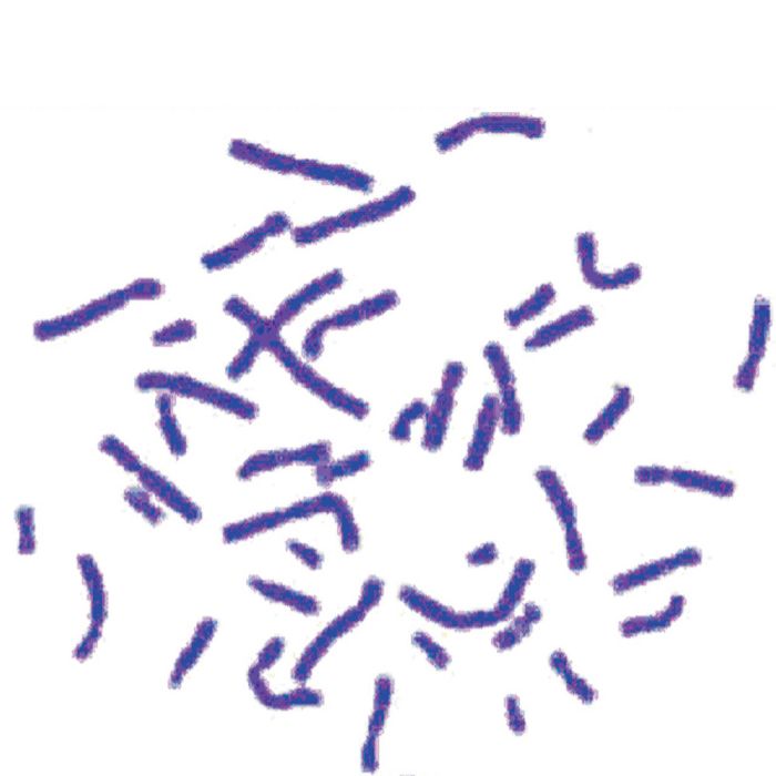 Himedia Giemsa Stain Solution