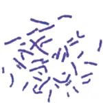 Himedia Giemsa Stain Solution