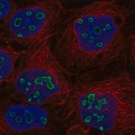 Merck Anti-TP53TG5 antibody produced in rabbit