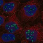 Merck Anti-TP53TG5 antibody produced in rabbit